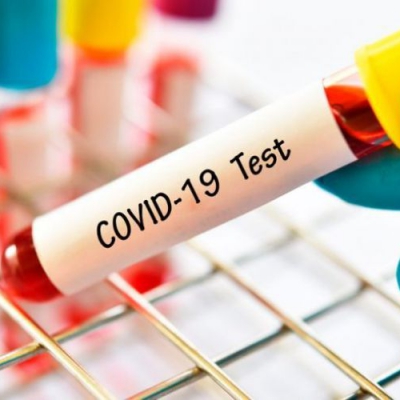 COVID- 19: Primer informe registra 20 casos positivos