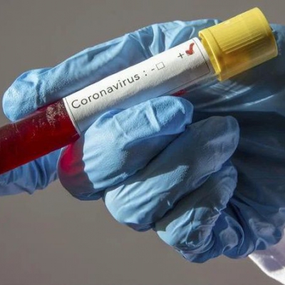 La Rioja cuenta con 20 nuevos positivos y 2 fallecidos por Coronavirus