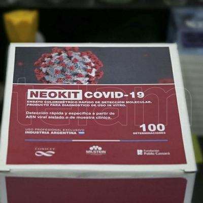 Diagnóstico, vigilancia e investigación: lo que permiten los cuatro test argentinos