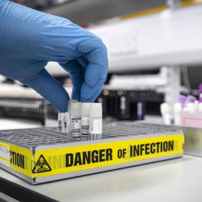 OMS: Todos los países deben compartir sus datos sobre el origen del covid-19 para no "politizar" la investigación